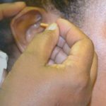 Acupunctuur voor behandeling adhd